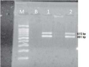 PCR agarose gel at 1.5% for the identification of fragments 491 and 615 bp