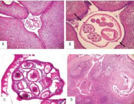 Histological sections of the lymph node and the tonsil