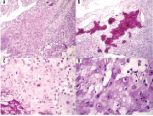 Histological sections stained with HE