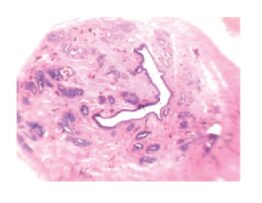 Histological panoramic view of prostate tissue