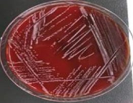 Bacterial Culture: Roseomonas spp